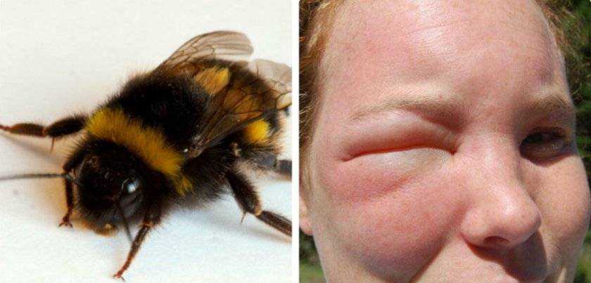 Жало пчелы